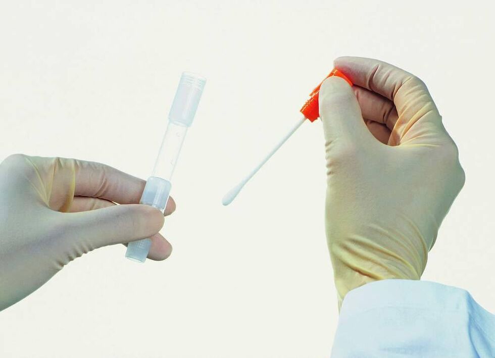 Tests verzamelen om chronische prostatitis op te sporen