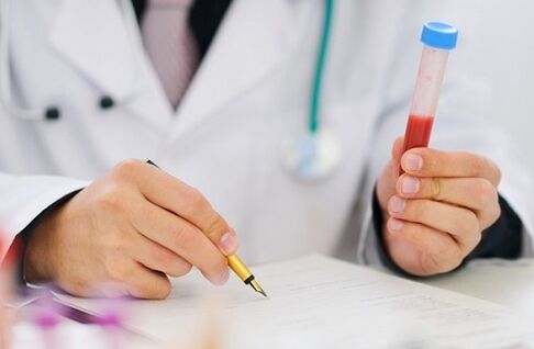 tests voor prostatitis voor het voorschrijven van medicijnen